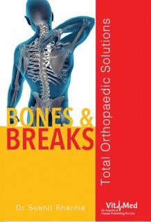 Bones & Breaks